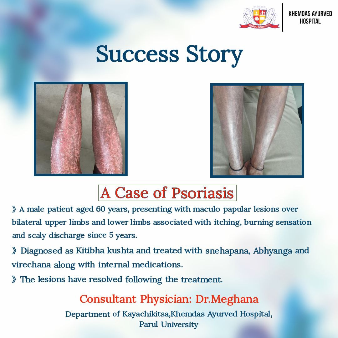 Success Story-1