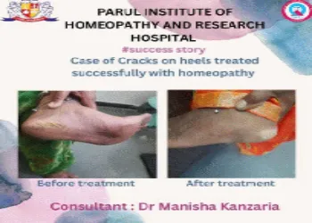 Success Story - Cracks Treatment